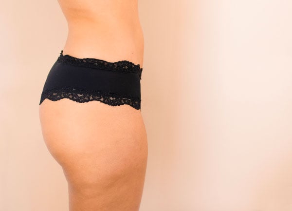 Comment enlever la cellulite