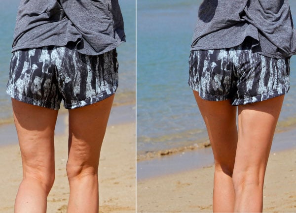 enlever la cellulite efficacement